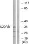 Interleukin-20 receptor subunit beta antibody, GTX87090, GeneTex, Western Blot image 