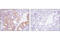 Ribosomal Protein S6 Kinase A1 antibody, 8753S, Cell Signaling Technology, Immunohistochemistry paraffin image 