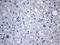 Thyroglobulin antibody, TA804362S, Origene, Immunohistochemistry paraffin image 