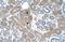 ST3 Beta-Galactoside Alpha-2,3-Sialyltransferase 5 antibody, NBP1-62444, Novus Biologicals, Immunohistochemistry paraffin image 