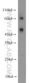 MAPK Activated Protein Kinase 2 antibody, 13949-1-AP, Proteintech Group, Western Blot image 