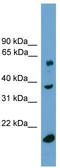Transducin Beta Like 1 Y-Linked antibody, TA339245, Origene, Western Blot image 