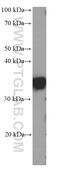 Small Glutamine Rich Tetratricopeptide Repeat Containing Alpha antibody, 60305-1-Ig, Proteintech Group, Western Blot image 