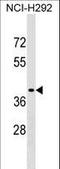 Sorting Nexin Family Member 21 antibody, LS-C159054, Lifespan Biosciences, Western Blot image 