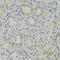 Stathmin 1 antibody, LS-C749032, Lifespan Biosciences, Immunohistochemistry paraffin image 