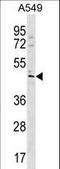 TBC1 Domain Family Member 20 antibody, LS-C157146, Lifespan Biosciences, Western Blot image 