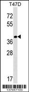 N-Terminal Asparagine Amidase antibody, 59-421, ProSci, Western Blot image 