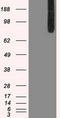 B-Raf Proto-Oncogene, Serine/Threonine Kinase antibody, LS-C114550, Lifespan Biosciences, Western Blot image 