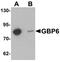 Guanylate Binding Protein Family Member 6 antibody, A13012, Boster Biological Technology, Western Blot image 