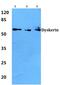 Dyskerin Pseudouridine Synthase 1 antibody, PA5-75217, Invitrogen Antibodies, Western Blot image 