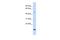 Forkhead Box N3 antibody, A07457, Boster Biological Technology, Western Blot image 