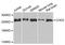 Chromodomain Helicase DNA Binding Protein 2 antibody, A5895, ABclonal Technology, Western Blot image 