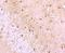 Solute Carrier Family 2 Member 3 antibody, NBP2-66872, Novus Biologicals, Immunohistochemistry paraffin image 