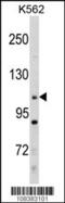 MLLT10 Histone Lysine Methyltransferase DOT1L Cofactor antibody, 60-305, ProSci, Western Blot image 
