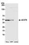 Acyl-CoA Thioesterase 9 antibody, NBP2-76376, Novus Biologicals, Western Blot image 