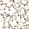 PHD Finger Protein 11 antibody, 14-982, ProSci, Immunohistochemistry paraffin image 