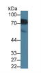 Methylenetetrahydrofolate Reductase antibody, LS-C373596, Lifespan Biosciences, Western Blot image 