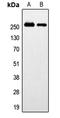 Probable G-protein coupled receptor 179 antibody, LS-C353684, Lifespan Biosciences, Western Blot image 