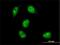 MYC Associated Factor X antibody, H00004149-M01, Novus Biologicals, Immunocytochemistry image 