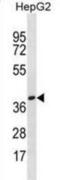 Olfactory Receptor Family 4 Subfamily X Member 1 (Gene/Pseudogene) antibody, abx030417, Abbexa, Western Blot image 