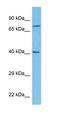 Carnitine Palmitoyltransferase 2 antibody, orb330557, Biorbyt, Western Blot image 