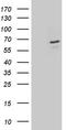 Dihydropyrimidinase Like 2 antibody, LS-C796010, Lifespan Biosciences, Western Blot image 