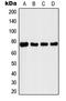 Interleukin 1 Receptor Associated Kinase 1 antibody, LS-C352383, Lifespan Biosciences, Western Blot image 
