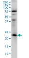 RAB3A, Member RAS Oncogene Family antibody, H00005864-M01, Novus Biologicals, Western Blot image 