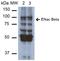 Sodium Channel Epithelial 1 Beta Subunit antibody, orb383764, Biorbyt, Western Blot image 