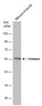 Nicotinamide Phosphoribosyltransferase antibody, GTX128973, GeneTex, Western Blot image 