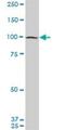 Eukaryotic Translation Initiation Factor 4 Gamma 2 antibody, H00001982-M01, Novus Biologicals, Western Blot image 