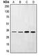 Ephrin-B3 antibody, MBS821734, MyBioSource, Western Blot image 