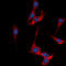 Somatostatin Receptor 1 antibody, LS-C368528, Lifespan Biosciences, Immunofluorescence image 