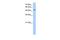 MFNG O-Fucosylpeptide 3-Beta-N-Acetylglucosaminyltransferase antibody, GTX46213, GeneTex, Western Blot image 