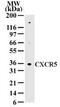 C-X-C Motif Chemokine Receptor 5 antibody, PA1-41135, Invitrogen Antibodies, Western Blot image 