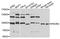 Phosphoinositide-3-Kinase Regulatory Subunit 2 antibody, STJ111242, St John