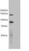 Actin Alpha 1, Skeletal Muscle antibody, orb18290, Biorbyt, Western Blot image 