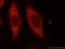 TBC1 Domain Family Member 17 antibody, 20482-1-AP, Proteintech Group, Immunofluorescence image 