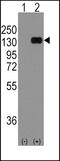 Cadherin 1 antibody, 57-983, ProSci, Western Blot image 