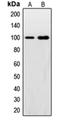 Synuclein Alpha Interacting Protein antibody, orb214918, Biorbyt, Western Blot image 