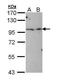 TBC1 Domain Containing Kinase antibody, PA5-34789, Invitrogen Antibodies, Western Blot image 