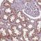 Zinc Finger Protein 605 antibody, HPA062655, Atlas Antibodies, Immunohistochemistry paraffin image 