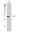 Syndecan 1 antibody, STJ97305, St John