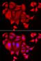 Solute Carrier Family 26 Member 2 antibody, LS-C335658, Lifespan Biosciences, Immunofluorescence image 