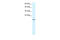 Zinc Finger Protein 7 antibody, 27-872, ProSci, Western Blot image 