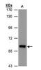 Aldehyde Dehydrogenase 6 Family Member A1 antibody, PA5-34691, Invitrogen Antibodies, Western Blot image 