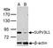 Suv3 Like RNA Helicase antibody, NBP2-20539, Novus Biologicals, Western Blot image 