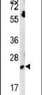 EBP Like antibody, PA5-25639, Invitrogen Antibodies, Western Blot image 