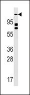 Unc-51 Like Autophagy Activating Kinase 2 antibody, LS-C101207, Lifespan Biosciences, Western Blot image 