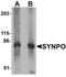 Synaptopodin antibody, PA5-21062, Invitrogen Antibodies, Western Blot image 